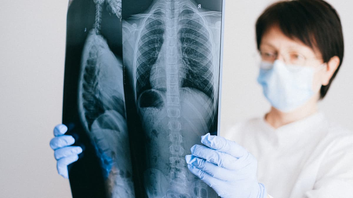 Interstitial Lung Disease